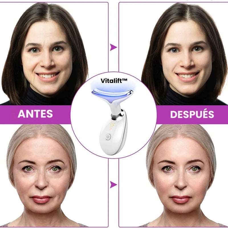 Masajeador Facial Anti Papada con Luz LED! 🌟